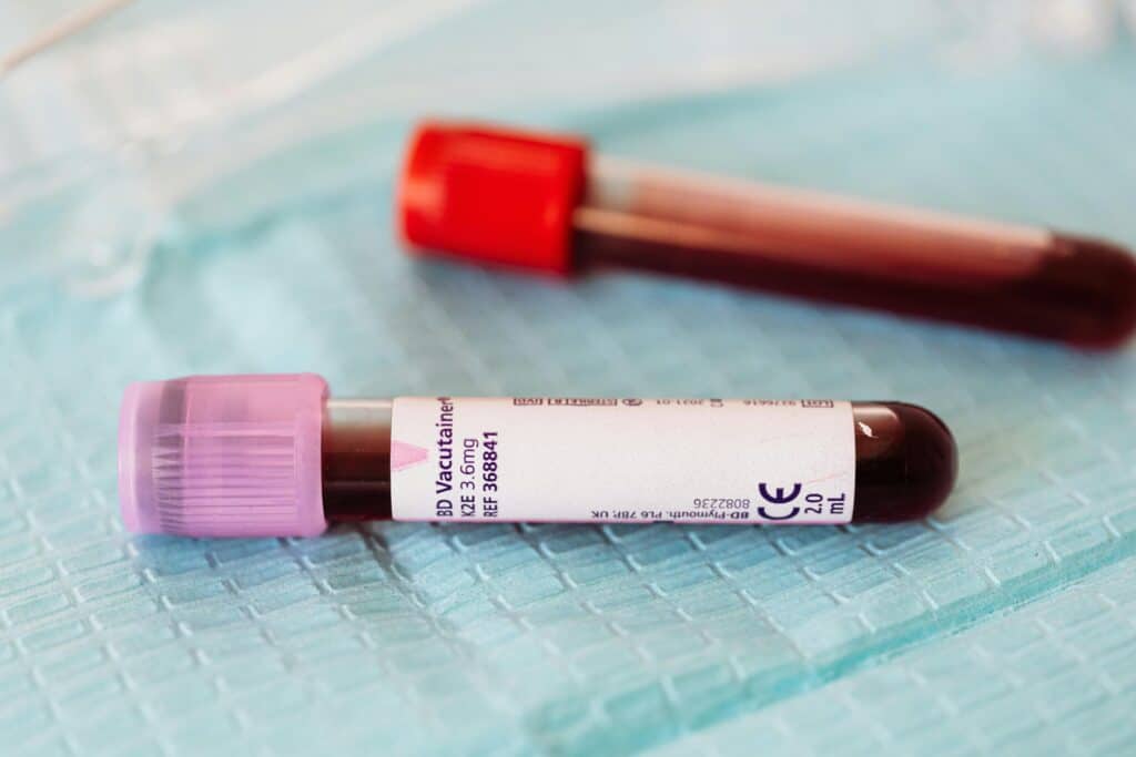 Becoming a Successful Phlebotomist