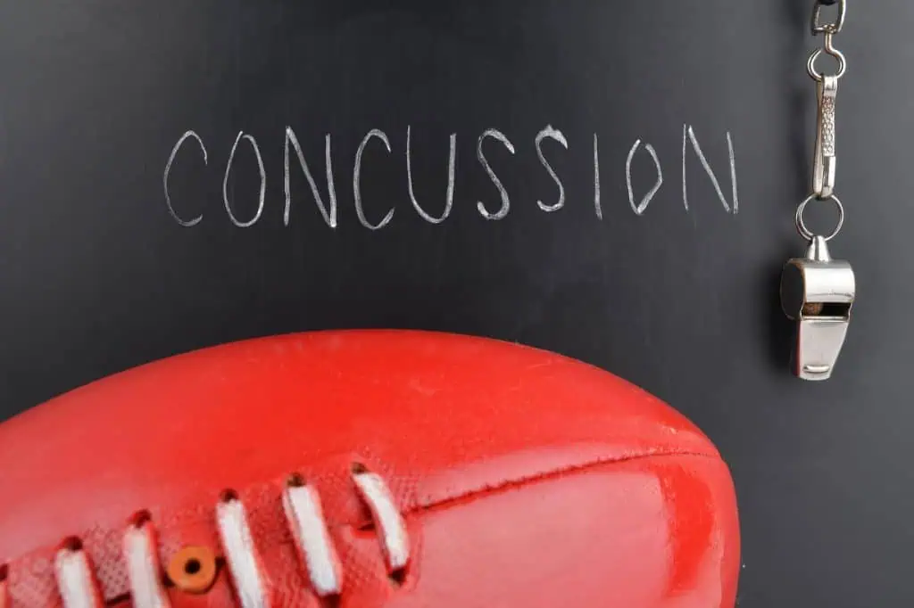 Concussions